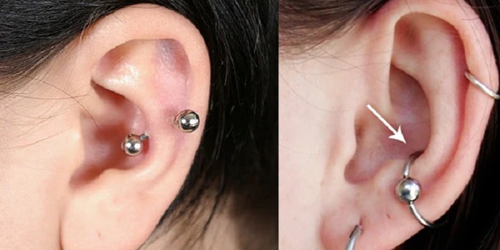 پیرسینگ گوش پیرسینگ لاله گوش (Auricle Piercing)
